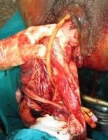 exvisceration-9_thumbnail.jpg