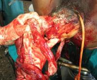 exvisceration-10_thumbnail.jpg