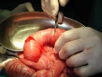 acaris-impaction2_thumbnail.jpg