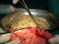 acaris-impaction4_thumbnail.jpg