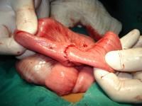 acaris-impaction8_thumbnail.jpg