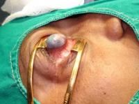 evisceration-5_thumbnail.jpg