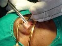 evisceration-6_thumbnail.jpg