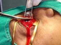 evisceration-7_thumbnail.jpg