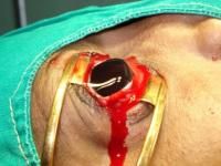 evisceration-8_thumbnail.jpg