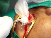evisceration-9_thumbnail.jpg
