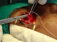 evisceration-10_thumbnail.jpg