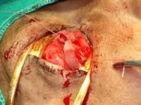 evisceration-11_thumbnail.jpg
