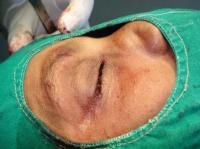evisceration-13_thumbnail.jpg