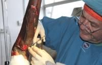 open-fracture-10_thumbnail.jpg