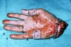 tnaccident-prone.jpg