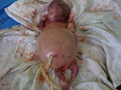 malformation.jpg