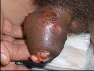 deformed penis4.jpg