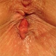 ImageUploadedByTapatalk1303666683.793312.jpg