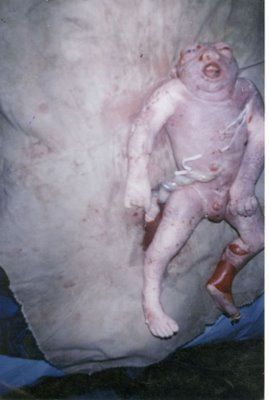uranium+victim3.jpg