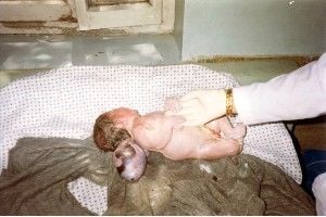 uranium+victim10.jpg
