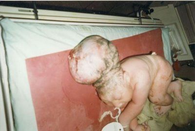 uranium+victim8.jpg