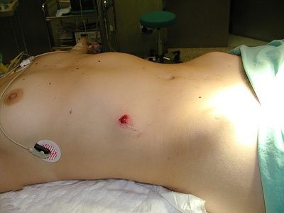 shot-stomach.jpg