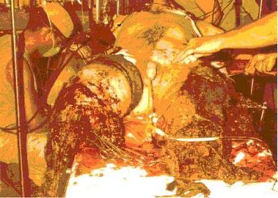 bomb-blast.jpg