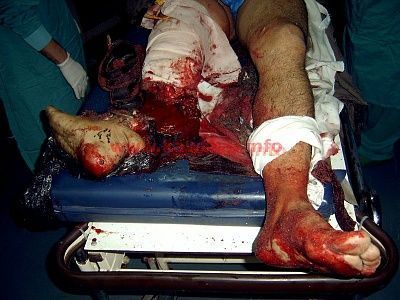 bomb-blast4.jpg