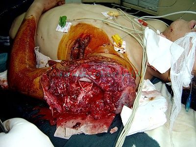bomb-blast5.jpg