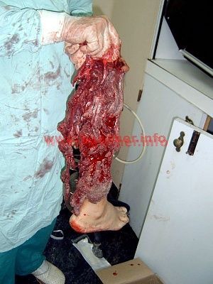 bomb-blast7.jpg