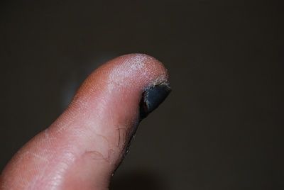 dead-nails.jpg