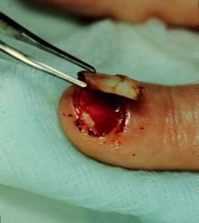 dead nails6.jpg
