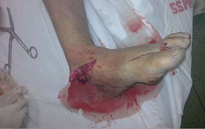 foot-break4.jpg