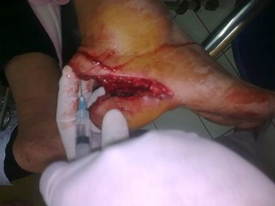 foot-slice.jpg