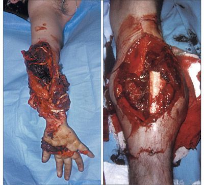 leg and arm ouchie.jpg