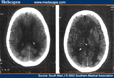 smj442908.fig1.gif