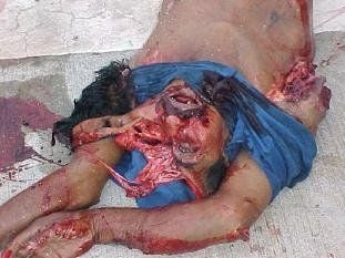 Car accident 4.jpg
