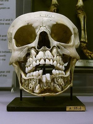 skull.jpg