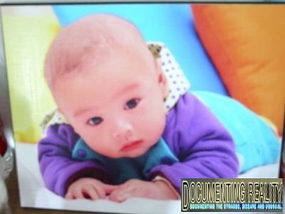 chinese-baby-atrophies-after-bcg-vaccine-.jpg