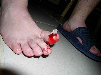 toe-nail.jpg