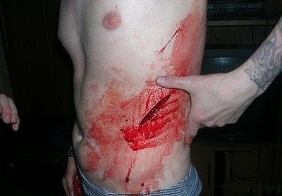 stabbed-after-argument.jpg