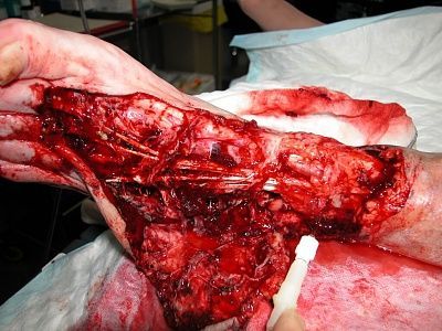 shredded_foot_.jpg