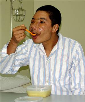 060425_face_transplant_vmed10a.widec.jpg