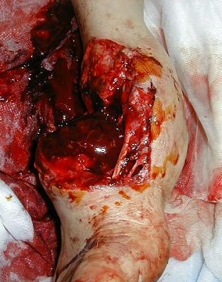 foot2.jpg