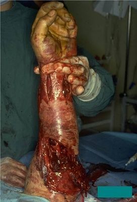 arm-bolted.jpg