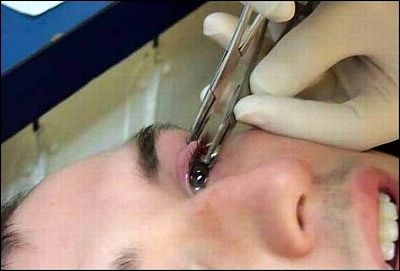 eyelid-piercing-8.jpg