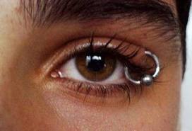 eyelid1.jpg
