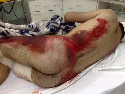 fell-off-motorbike.jpg