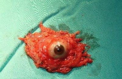 eye-eye.jpg