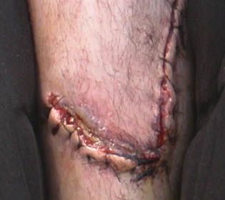 scarred109_11.jpg