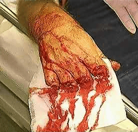 fingers.PNG
