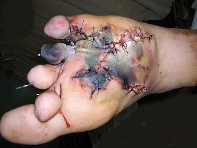 210256964d1300642129_foot.jpg