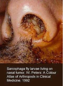 nasal-worms.jpg