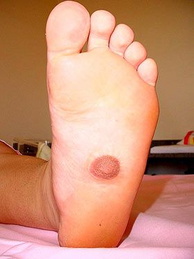 nipple-foot-MAIN_1346263a.jpg